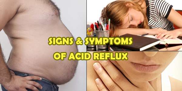 acid reflux symptoms