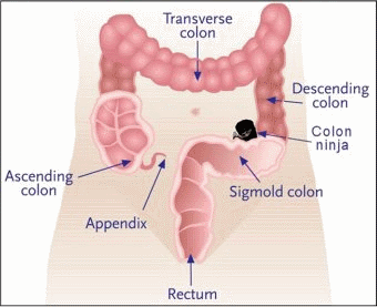 at home colon cleanse